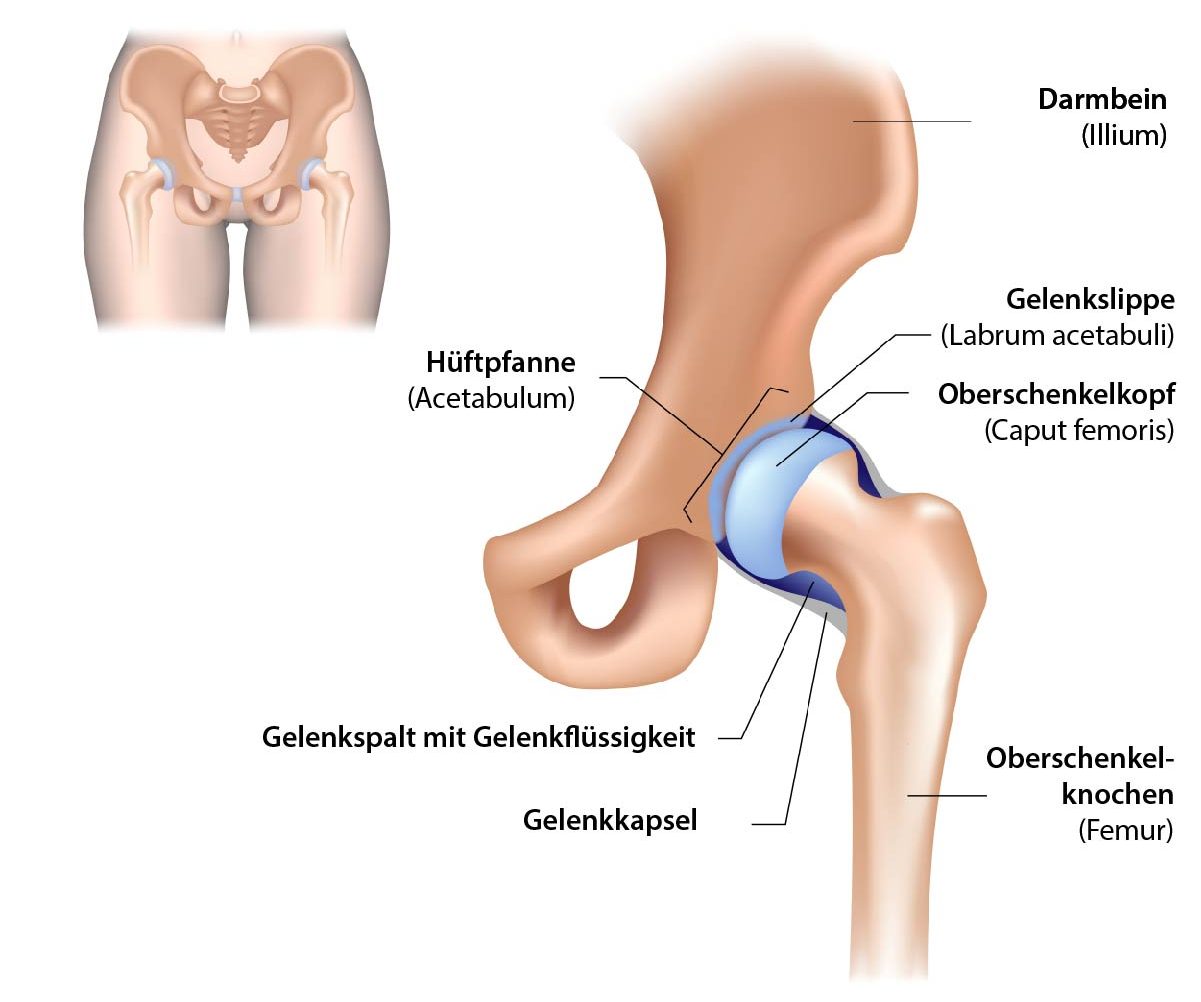 Hftarthrose (Coxarthrose) | Orthopde Wien 1030