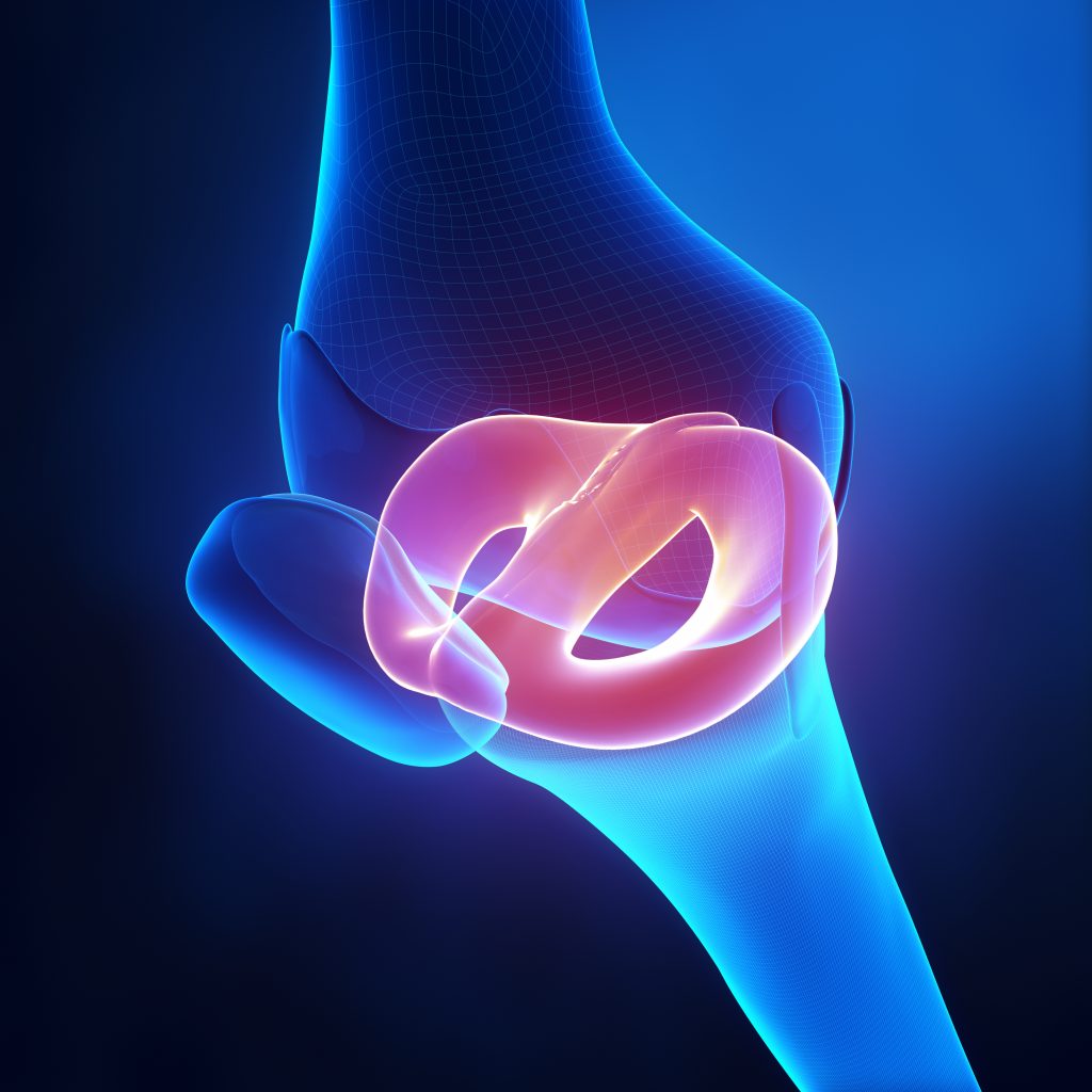Meniskusriss Meniskus OP Orthopäde Wien Dr. Gustav Timmel